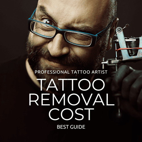 how much does tattoo removal cost